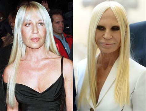 donatella versace cirugia|donatella versace before and after.